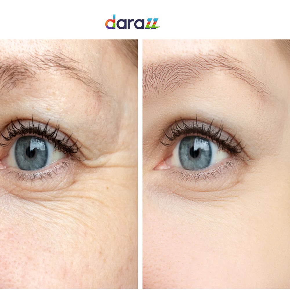 EYE WRINKLE