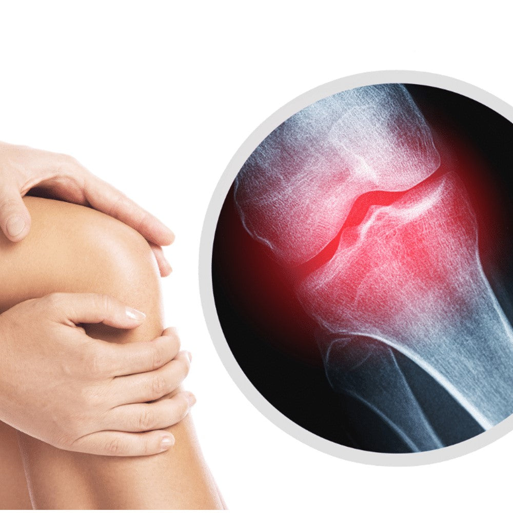 Joint & Bone Health